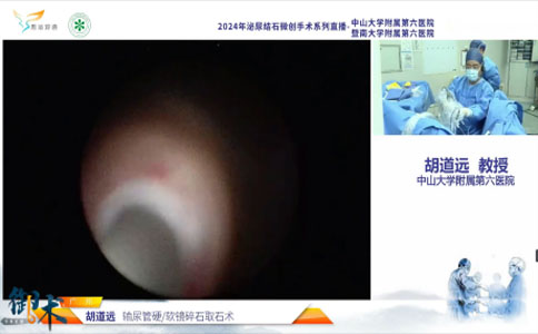 輸尿管硬/軟鏡碎石取石術(shù)