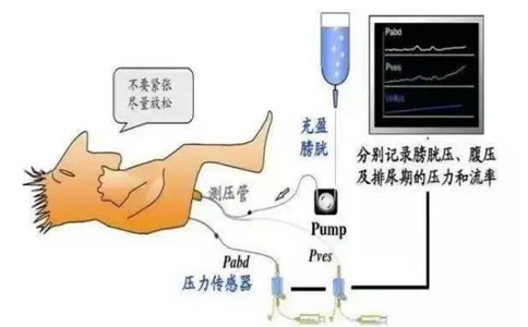 尿動力學(xué)檢查