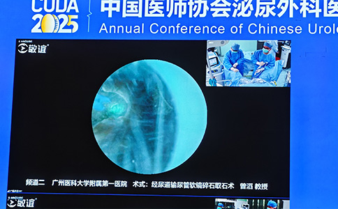 120W高功率鈥激光