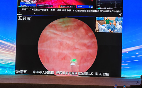 大鋼炮碎石